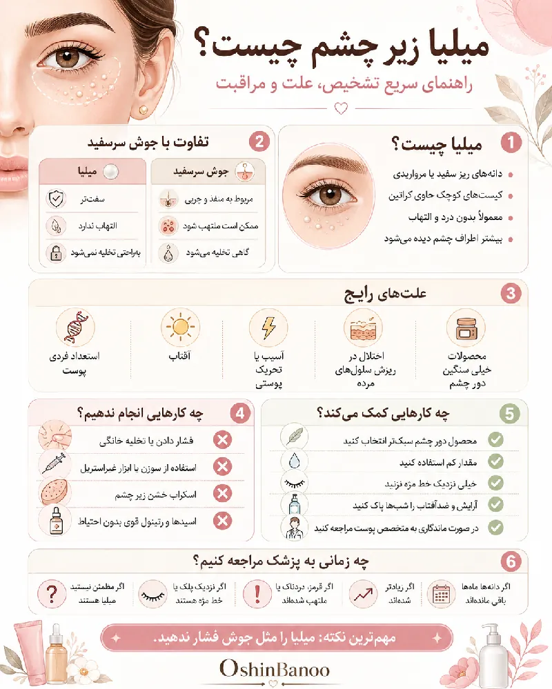 میلیا زیر چشم